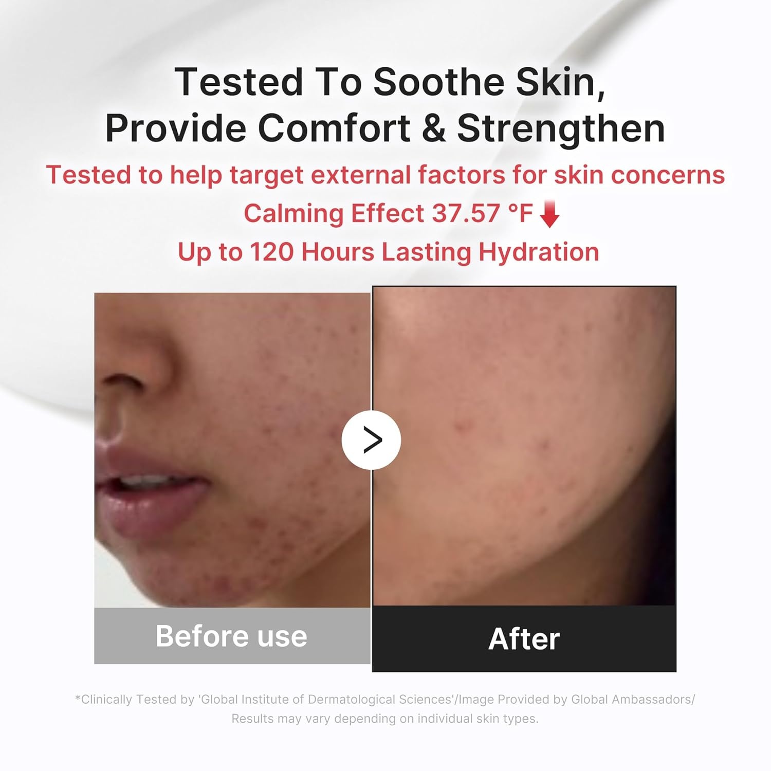 image:imagemedicube 3H Daily Relief Cream for All Skin Types amp After Spot Care Lightweight Comforting amp Soothing Moisturizer Guaiazulene Centella Ceramide for Balance and Hydration Korean Skincare