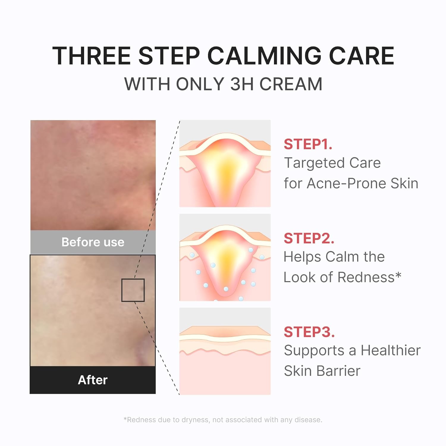 image:imagemedicube 3H Daily Relief Cream for All Skin Types amp After Spot Care Lightweight Comforting amp Soothing Moisturizer Guaiazulene Centella Ceramide for Balance and Hydration Korean Skincare