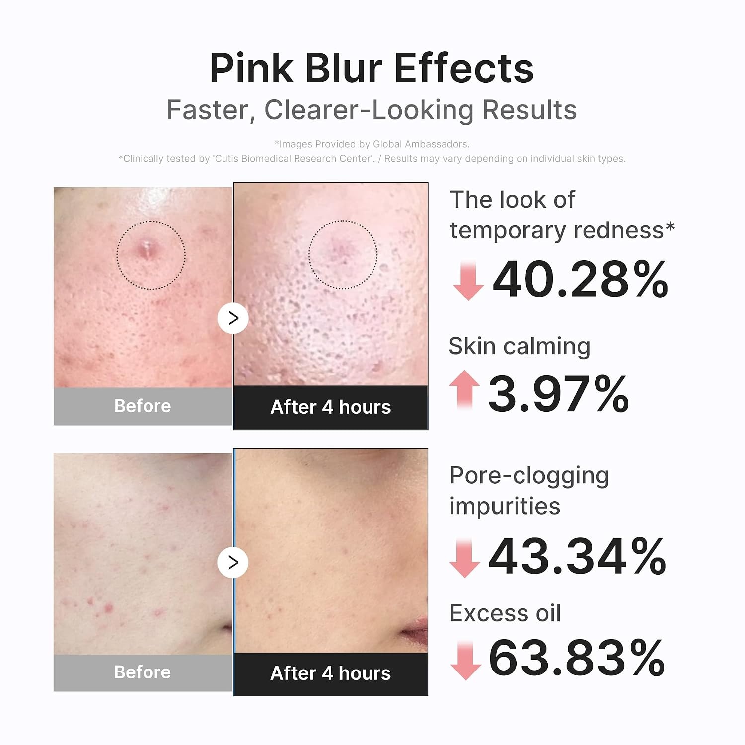 image:imagemedicube 3H Overnight Drying Lotion for Targeted Spot Care Spot Care for Troubled amp Oily Skin Calming Care with Calamine Centella amp Tea Tree Korean Skincare 067 fl oz071 Ounce Pack of 1