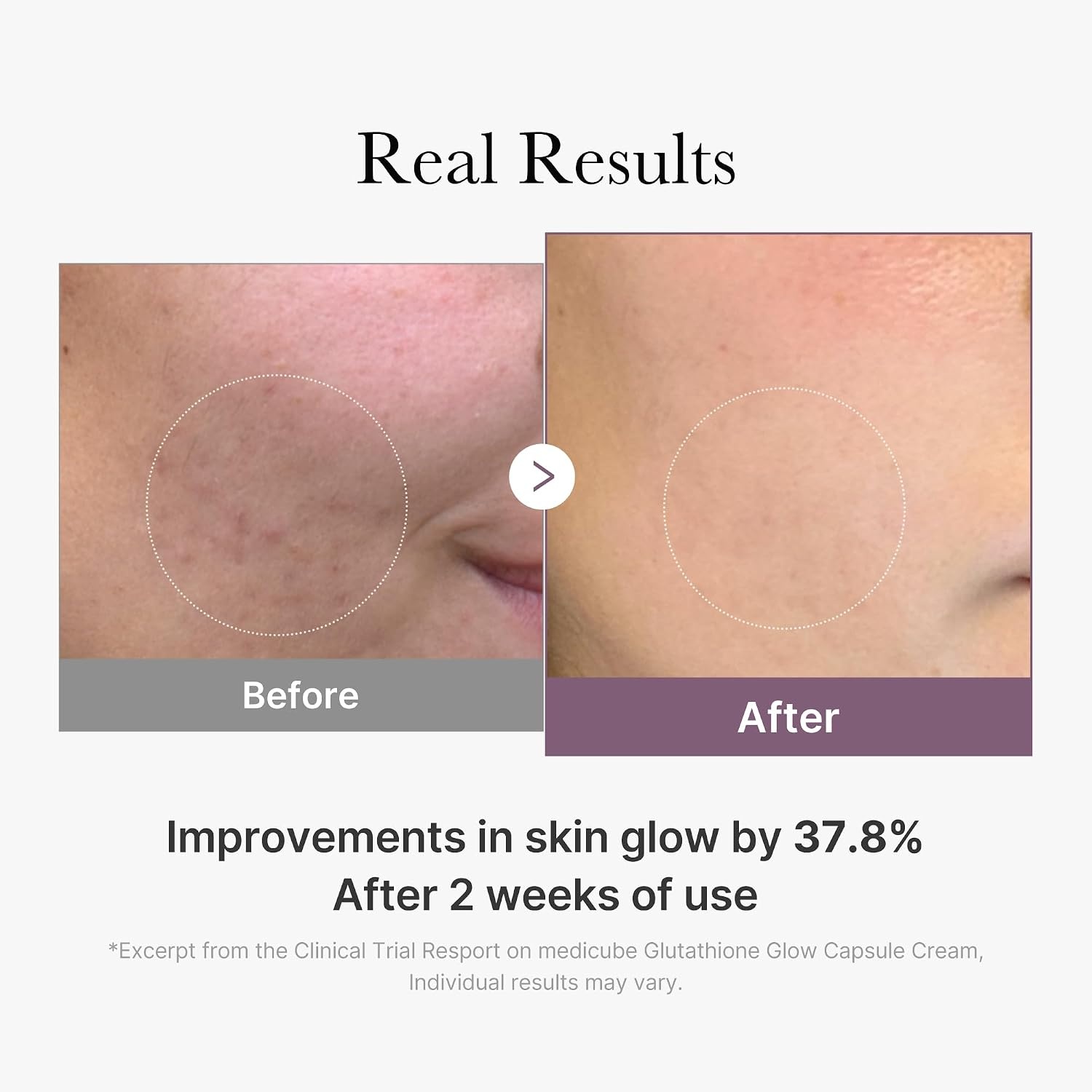 image:imagemedicube AGER Glutathione Glow Capsule Facial Cream Plump amp Hydrating Moisturizer with Collagen Peptide Soothing amp Glow Care Korean Skincare 169 floz169 Fl Oz Pack of 1