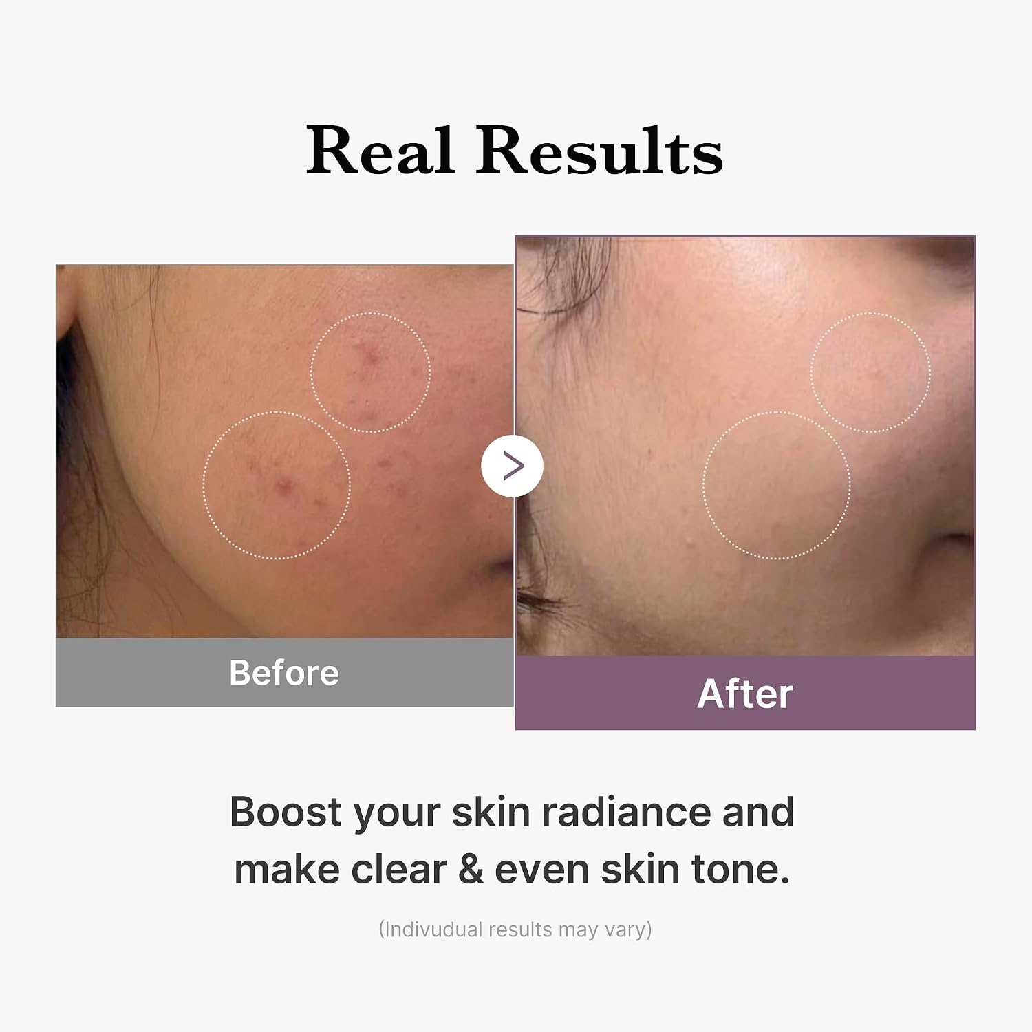 image:imagemedicube All Over Glow Skin Duo Deep Vitamin C Golden Capsule Face Moisturizer and AgeR Glutathione Glow Milky Toner