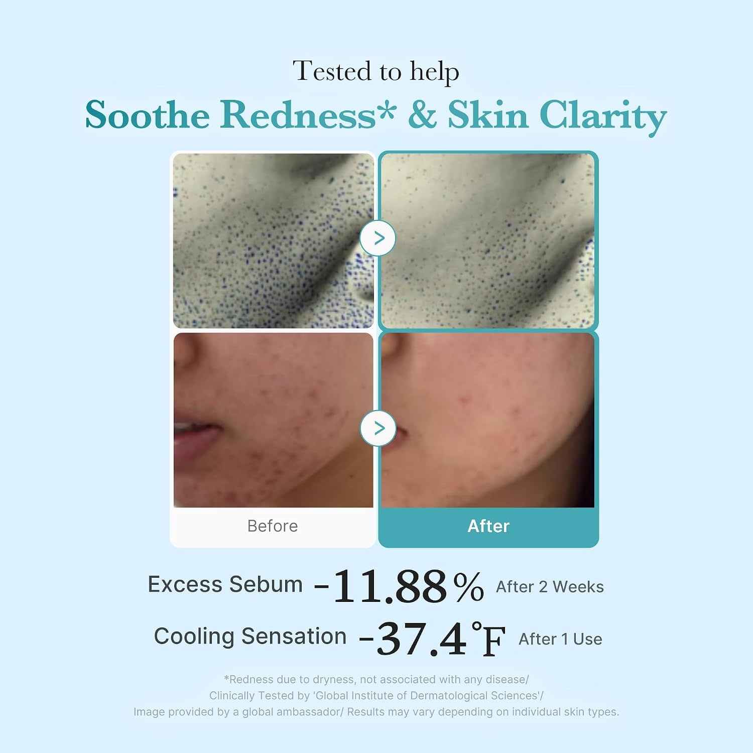 image:imagemedicube Azelaic Acid Niacinamide Clarifying Toner Troubled Skin Care Ideal for Purifying amp Calming with 4 Azelaic Acid amp 2 Niacinamide Korean Skin Care 845 floz