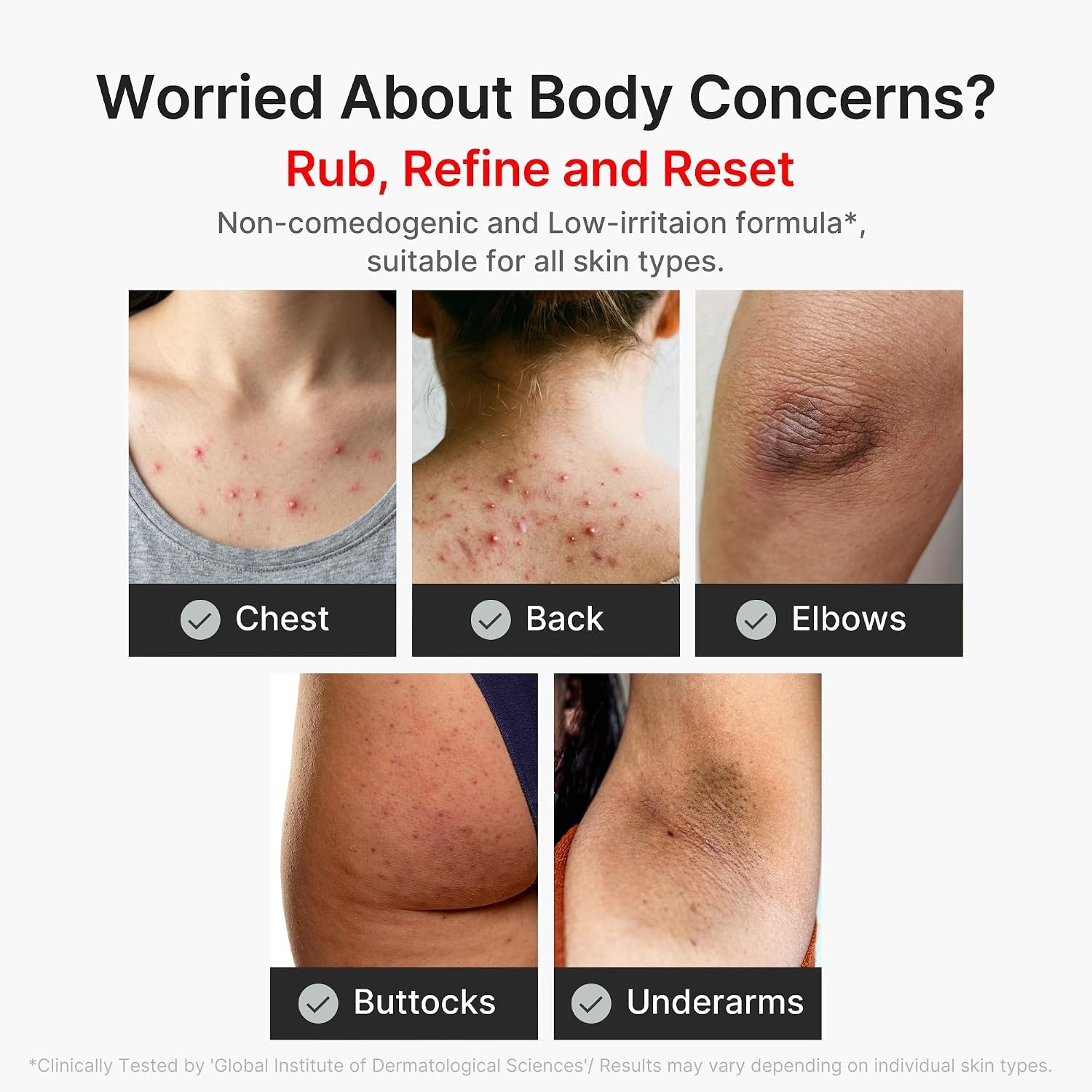 image:imagemedicube Body Peel Shot with Hypochlorous Acid Gentle Body Exfoliating for Dead Skin Cells amp Uneven Texture Rice Extract Panthenol for Hydrating amp Smoothing 946 floz946 Fl Oz Pack of 1