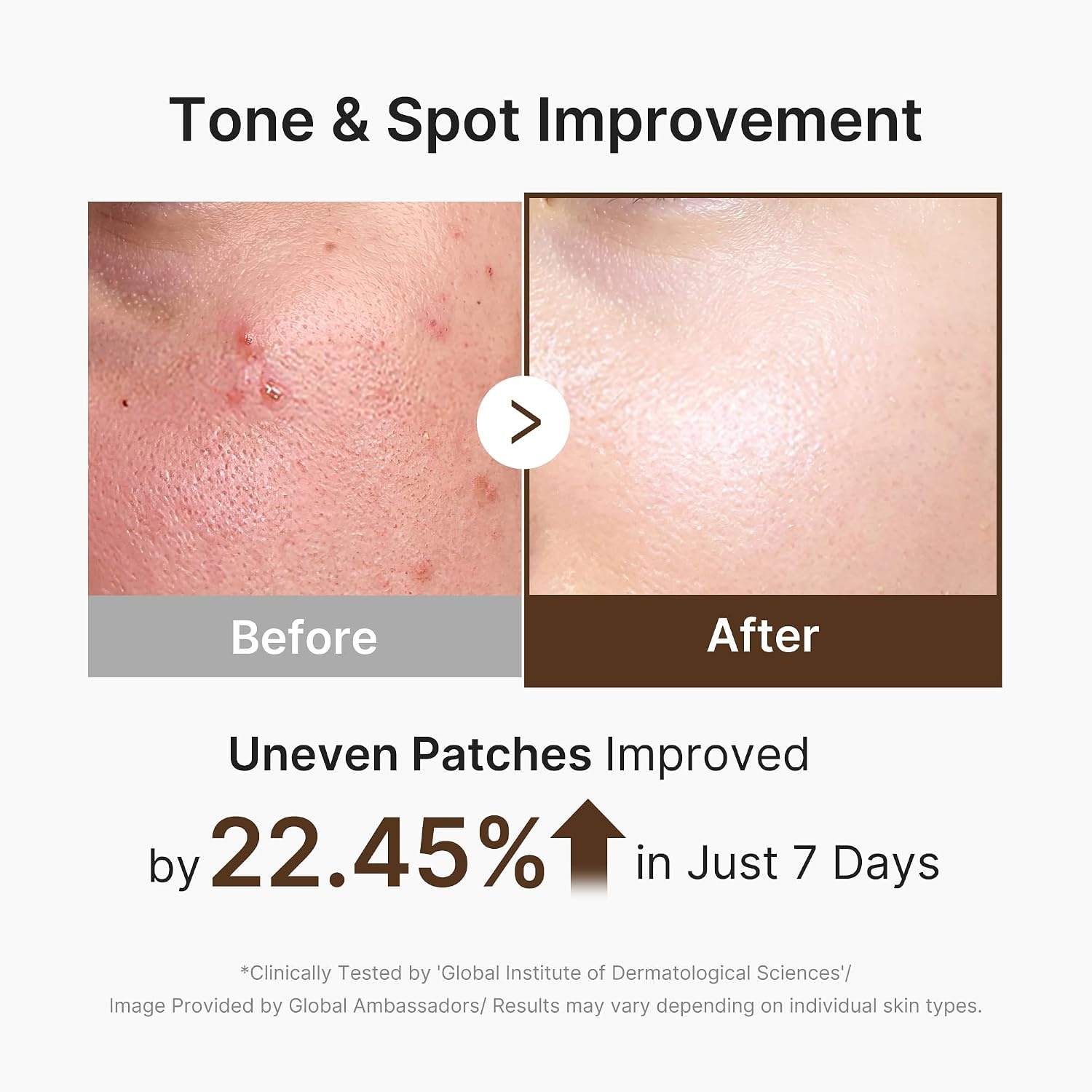 image:imagemedicube Capsule Cream with TXA Niacinamide Dual Radiance Moisturizer Ideal for Use After Spot Care Uneven Skin Tone amp Texture amp Hydration 99 Pure Tranexamic Acid Korean Skincare 194 ozDeep Vitamin C