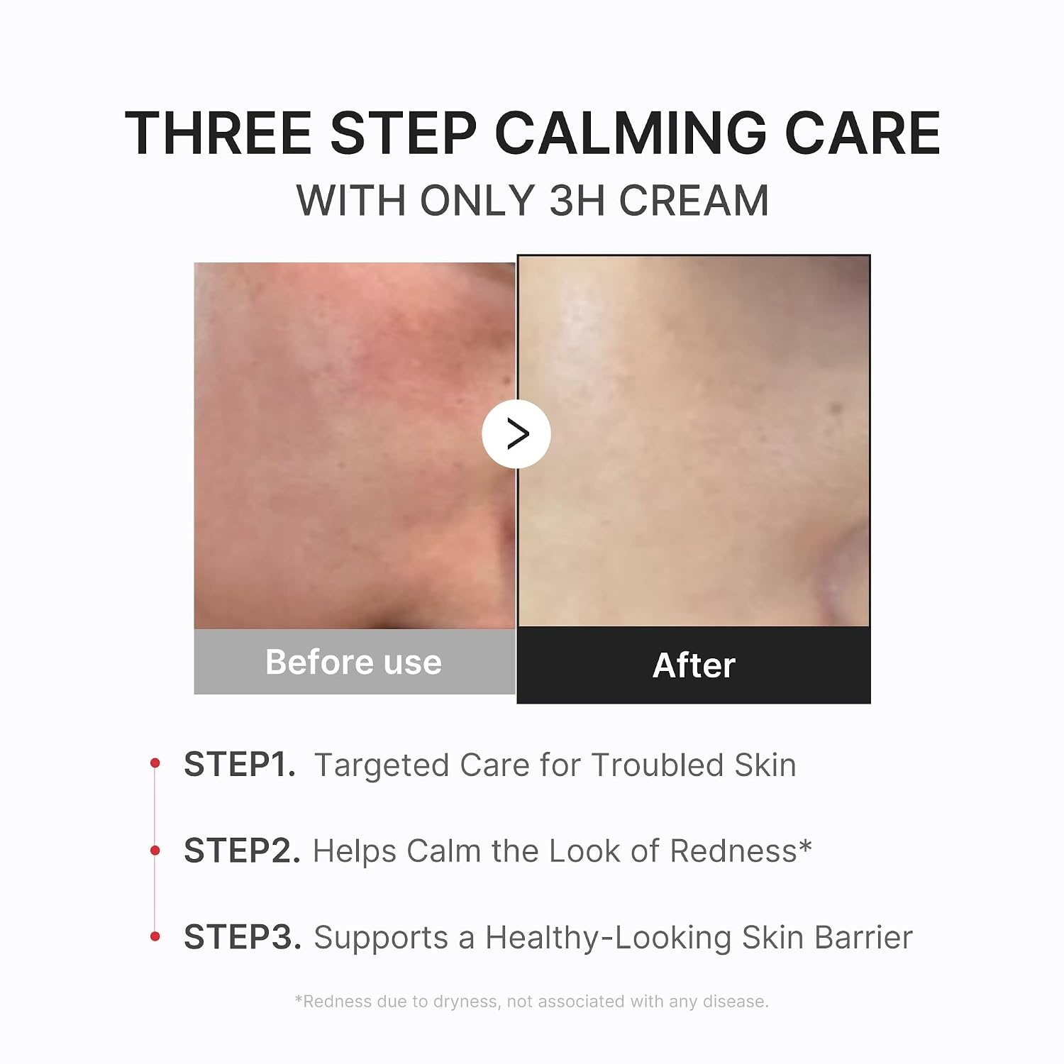 image:imagemedicube Clear amp Calm Skin Duo Hypochlorous Acid Peel Shot and 3H Relief Cream Gentle Exfoliating Serum for Dead Skin Cells and Calm with Daily Soothing Moisturizer For Clearer Smoother Skin