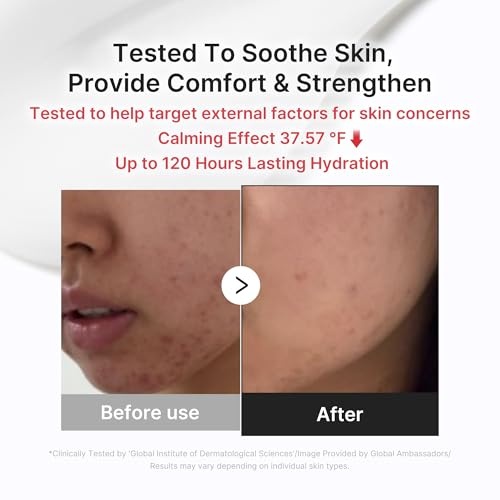image:imagemedicube Comforting Serum amp Cream Duo Ideal for After Spot Care TXA Serum and 3H Daily Moisturizer Soothing Skincare Set Calming Tone Refining amp Glow Routine Korean skincare