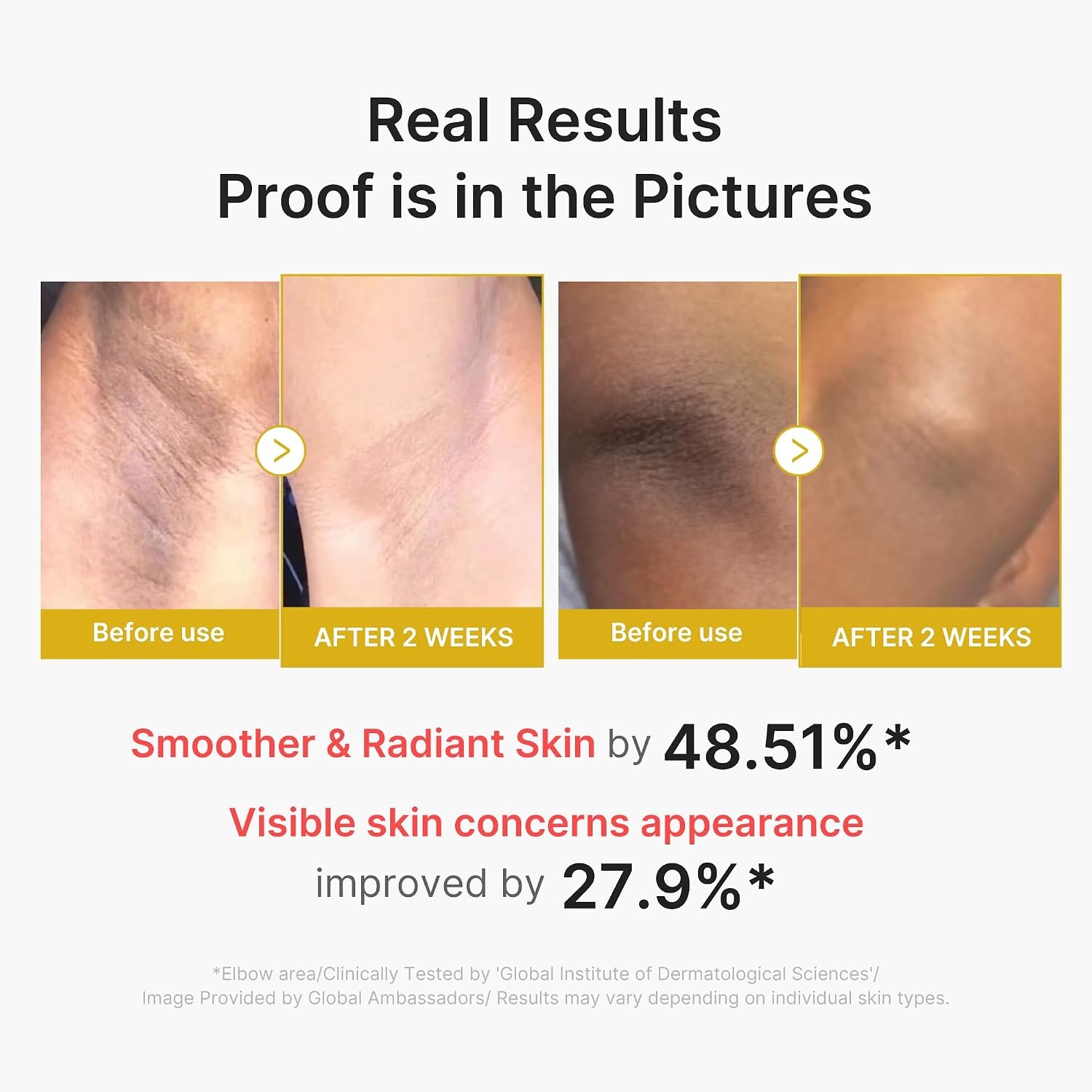 image:imagemedicube Dual Body Peel Shot Duo Hypochlorous Acid and Turmeric Body Peel Shot for Gentle Exfoliation for Dead Skin Cells Rough Patches and Visible Concerns Brightening amp Calming Skincare Set