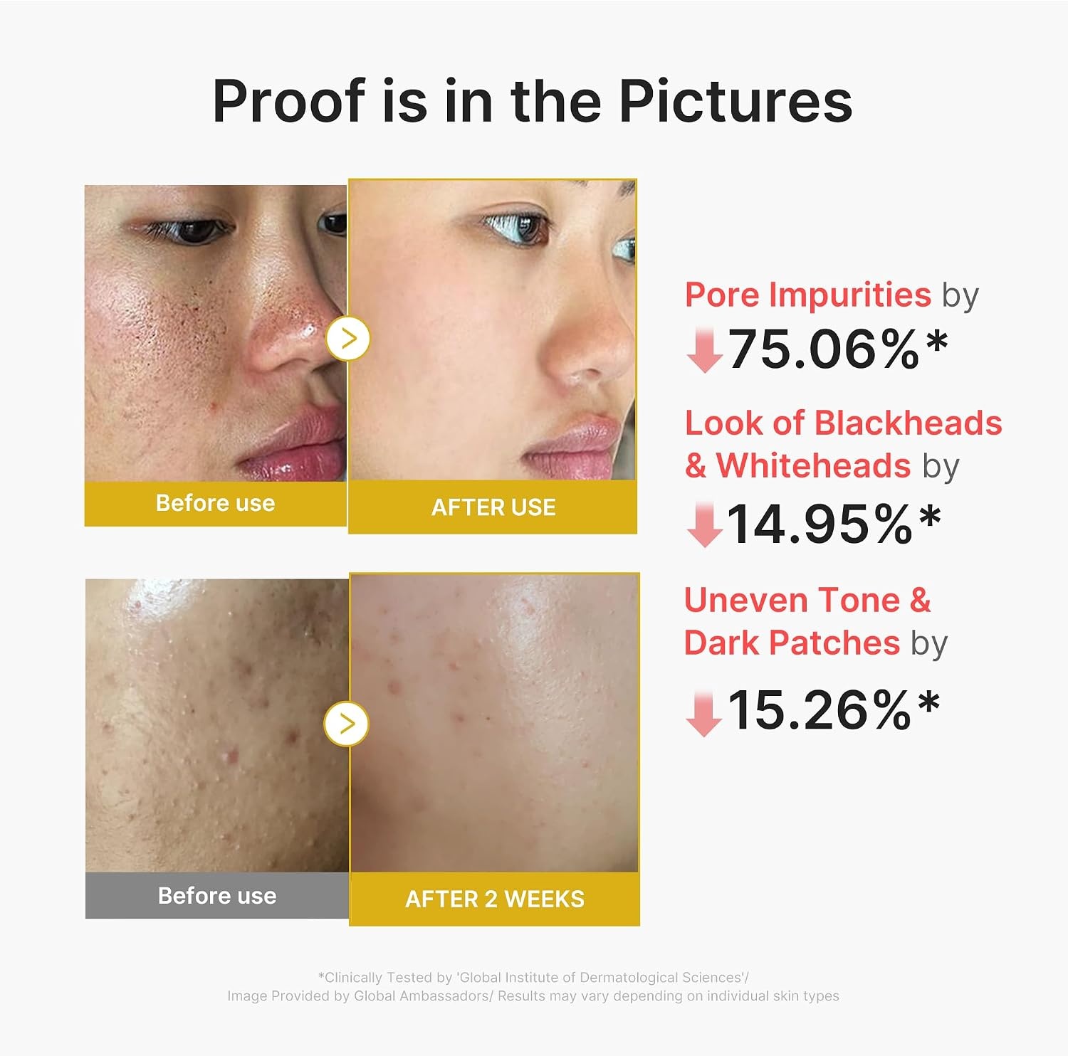image:imagemedicube Dual Peel Shot Exfoliating Duo Hypochlorous Acid and Turmeric Facial Peel Shots Targeted Pore Excess Sebum amp Texture Care Soothing amp Calming with HOCI amp Turmeric Hydrating Glow Care