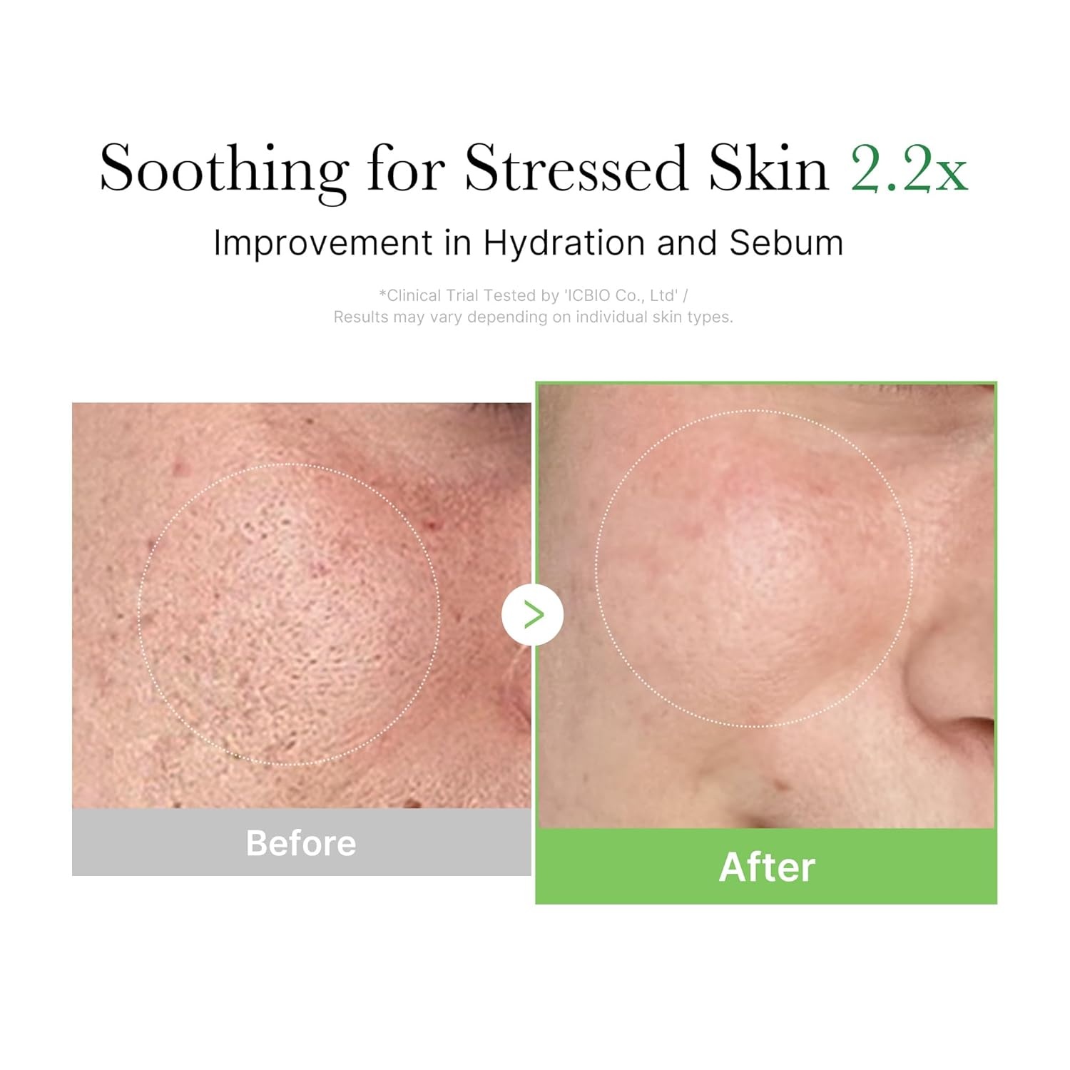 image:imagemedicube Exosome Cica Tea Tree Cream for Sensitive Skin with Centella Asiatica help reduce redness and breakouts Lowirritating Moisturizing Daily Texture Care Korean Skincare 17 fl oz