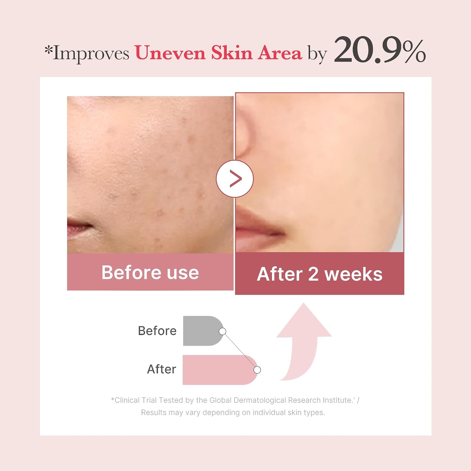 image:imagemedicube Exosome Shot Azelaic Acid 7500 PPM Spicule Facial Serum Ideal for Use After Spot Care amp Smoothing with Azelaic Acid Niacinamide Korean Skincare 101 floz101 Fl Oz Pack of 1