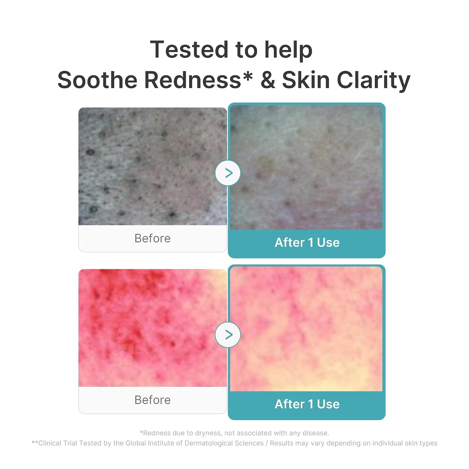 image:imagemedicube Facial Cleanser Zero Foam Cleanser for Pore amp Excess Oil Care Daily Gentle Cleansing Foam Excess Sebum Control Hydration Pore Minimization Korean Skincare Sensitive Skin 423 oz423 Fl Oz Pack of 1