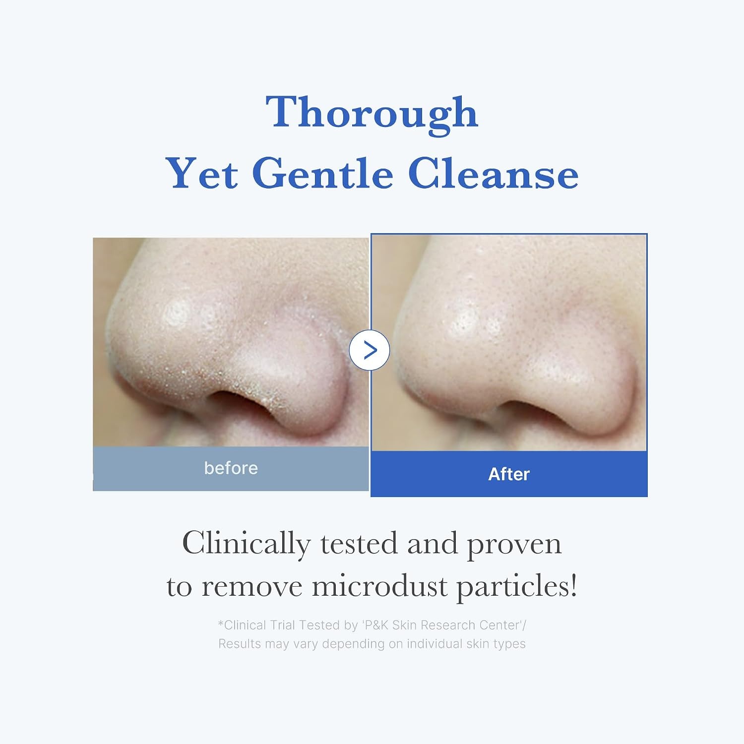 image:imagemedicube Facial Cleanser Zero Foam Cleanser for Pore amp Excess Oil Care Daily Gentle Cleansing Foam Excess Sebum Control Hydration Pore Minimization Korean Skincare Sensitive Skin 423 oz423 Fl Oz Pack of 1