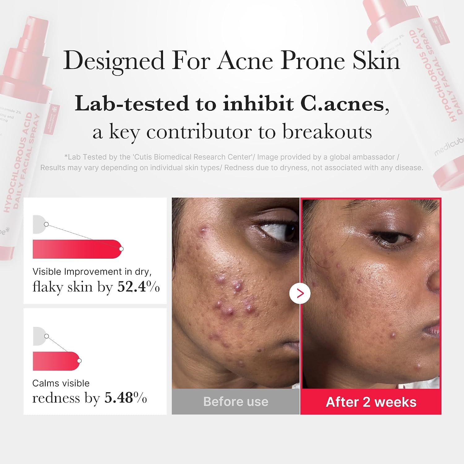 image:imagemedicube Red Power Duo for After Spot Care Use TXANiacinamide 15 Glow Facial Serum and Power Soothing Spray