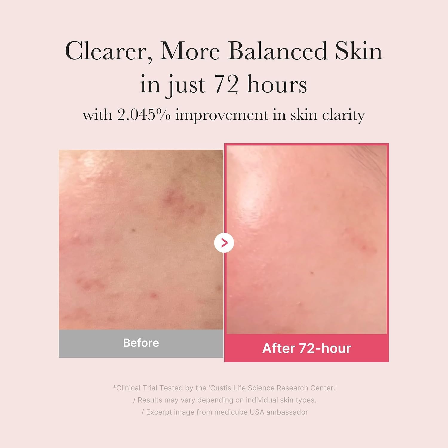 image:imagemedicube Ultimate Clear Glass Skin Serum Duo TXA Niacinamide 15 Glow Facial Serum and PDRN Pink Peptide Serum for Uneven Skin Tone and Texture Korean Skincare Gifts for Women