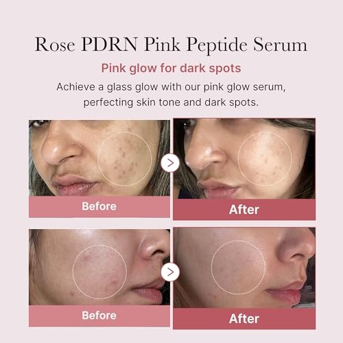 image:imagemedicube Viral Serum Duo for Clear and Plump Skin Kojic Acid Turmeric and PDRN Rose Pink Serum for Radiant Glow and Uneven Skin Tone amp Texture Care Giftable Skincare Set