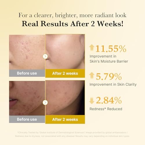 image:imagemedicube Viral Serum Duo for Clear and Plump Skin Kojic Acid Turmeric and PDRN Rose Pink Serum for Radiant Glow and Uneven Skin Tone amp Texture Care Giftable Skincare Set