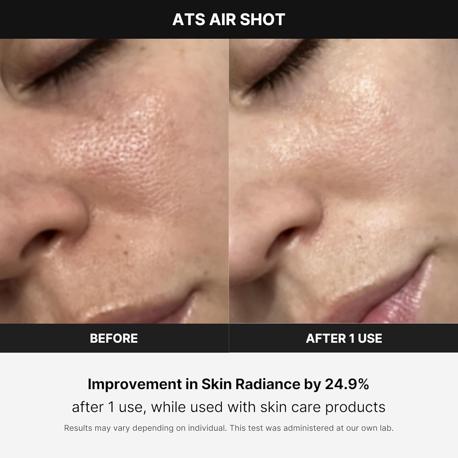 image:imageMedicube AgeR ATS Air Shot Microneedling Pore Tightening Skin Care Device for Enhanced Absorption Pore Refinement and Smoother Skin Texture Exfoliation Skin Rejuvenation Korean Skin Care