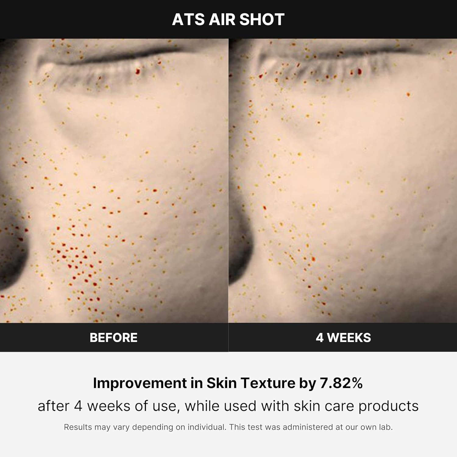 image:imageMedicube AgeR ATS Air Shot Microneedling Pore Tightening Skin Care Device for Enhanced Absorption Pore Refinement and Smoother Skin Texture Exfoliation Skin Rejuvenation Korean Skin Care