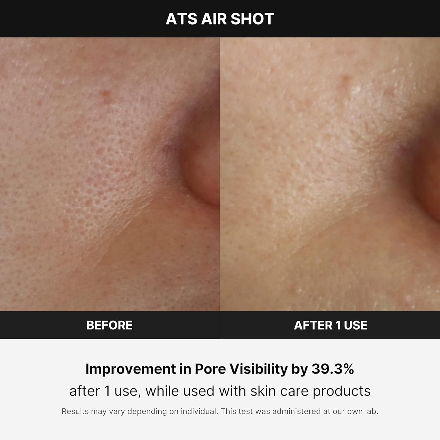 image:imageMedicube AgeR ATS Air Shot Microneedling Pore Tightening Skin Care Device for Enhanced Absorption Pore Refinement and Smoother Skin Texture Exfoliation Skin Rejuvenation Korean Skin Care