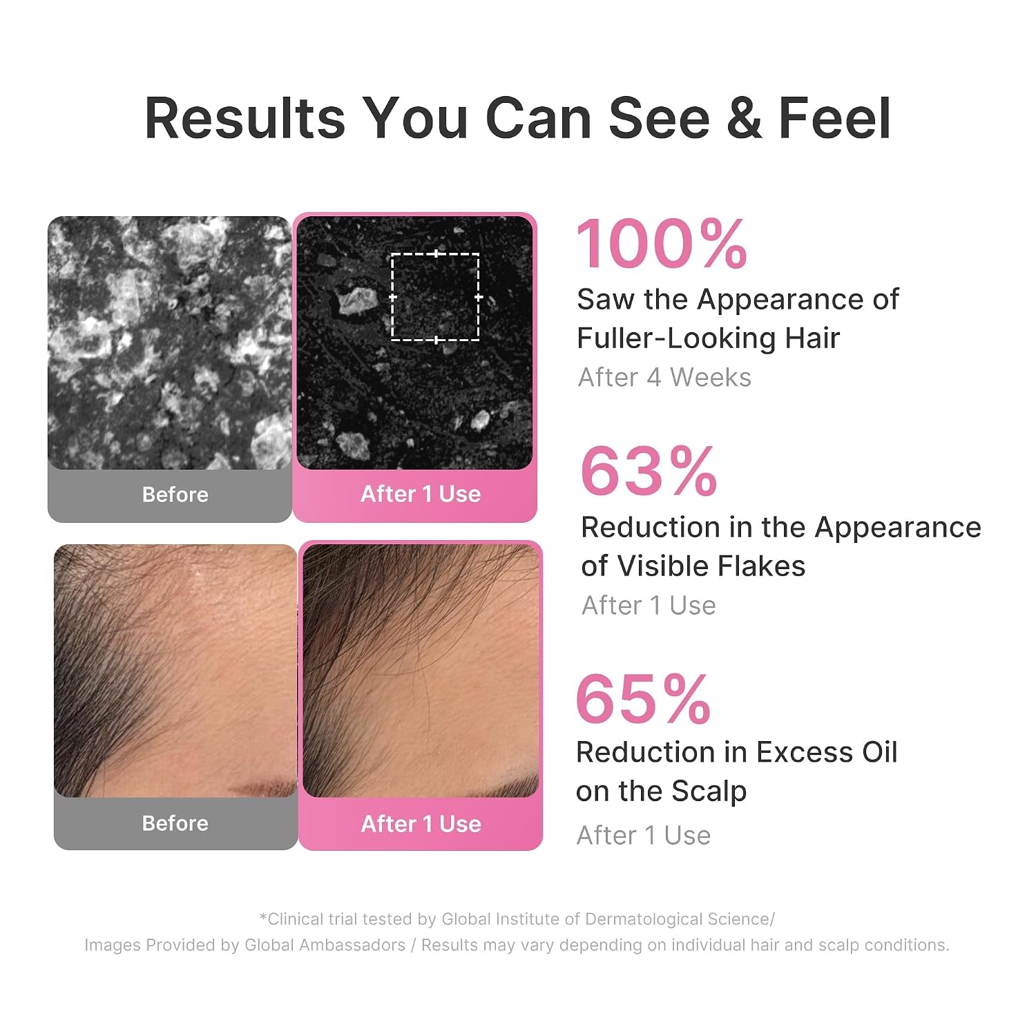 image:imagemedicube 3Step Cooling Scalp amp Hair Trio Rosemary PDRN Shampoo Conditioner and Deoxyribose Serum Refresh amp Cooling Care for ThinLooking Strands Korean Hair Care