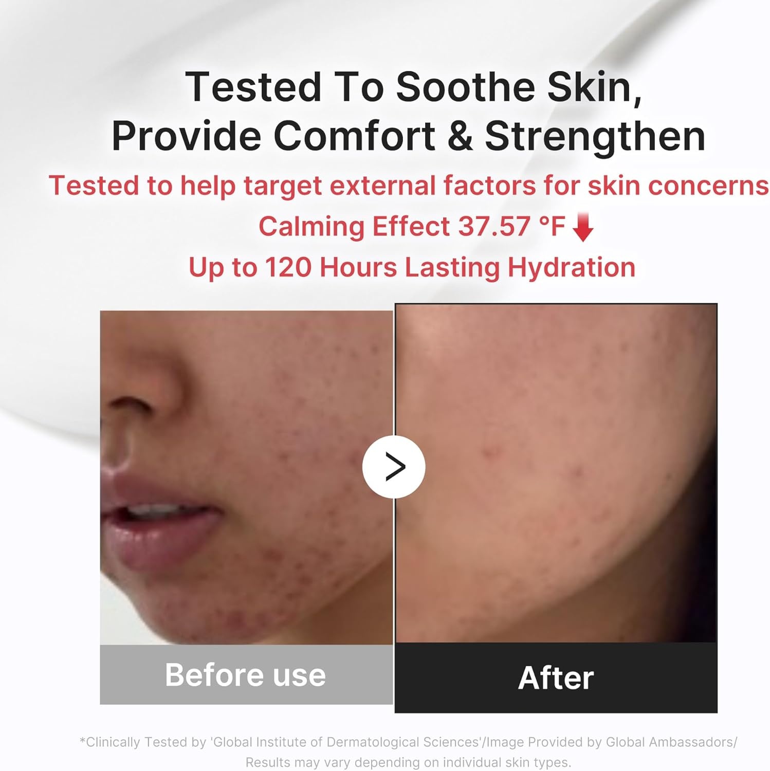 image:imagemedicube Clarifying Pad amp Soothing Cream Duo Red Succinic Acid Pad and 3H Daily Daily Moisturizer Gentle Exfoliation for Clearer Radiant Skin Balance amp Comfort Care Routine