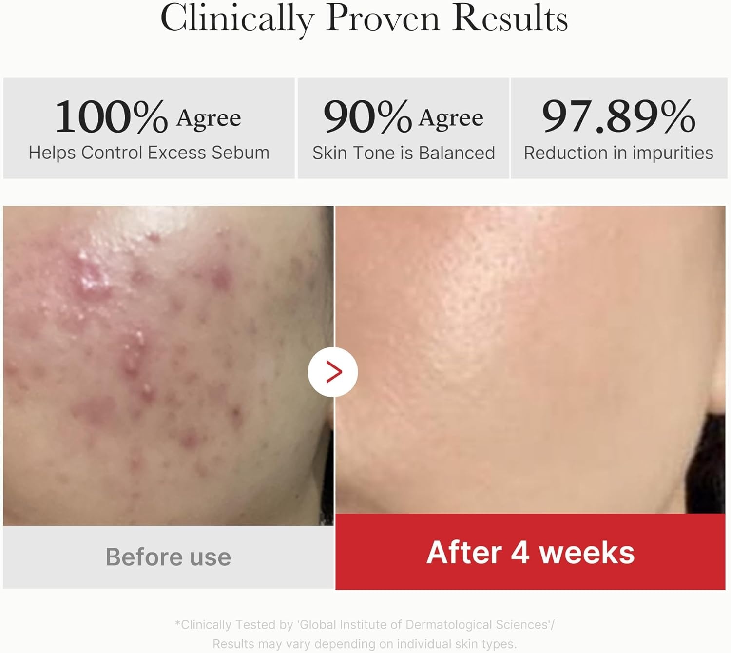 image:imagemedicube Clarifying Pad amp Soothing Cream Duo Red Succinic Acid Pad and 3H Daily Daily Moisturizer Gentle Exfoliation for Clearer Radiant Skin Balance amp Comfort Care Routine