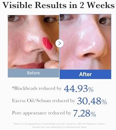 image:imagemedicube ClarifytoGlow Masking Set Zero Pore Pad 20 Collagen Glazed Milky Daytime Wrapping Mask for Exfoliation and Pore Care with LHA BHA Quick amp Easy Glow Care for Plumped Skin