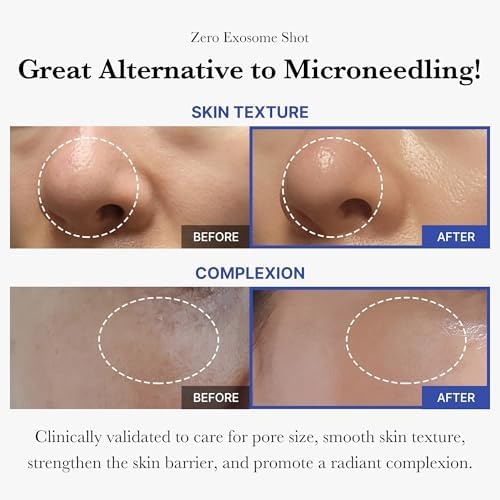 image:imagemedicube Daily Toner Pads with Exosome 2000 for Pore Care medicube Zero Pore Pads 20 and Zero Exosome Shot 2000 PPM Spicule Facial Serum