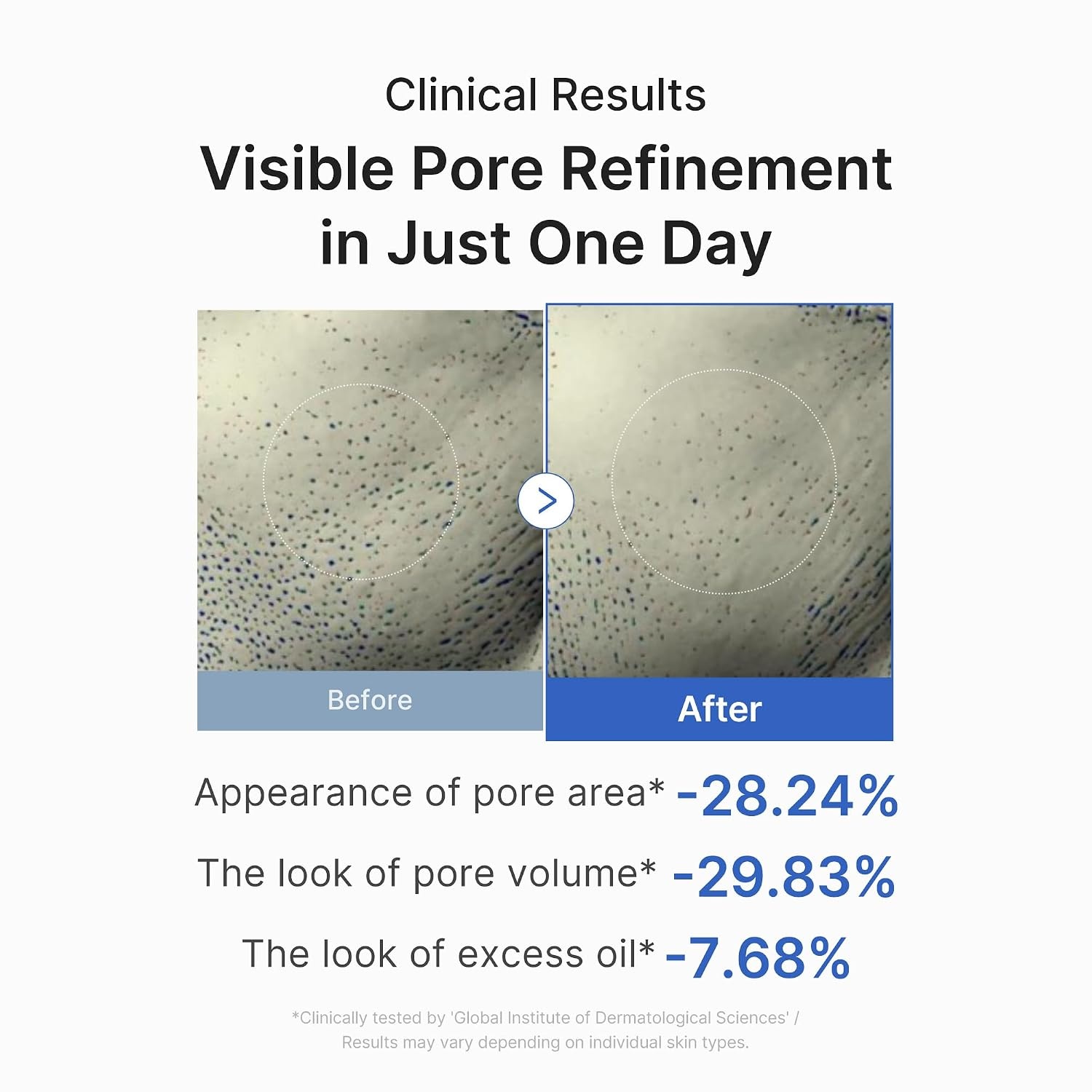 image:imagemedicube Daily Zero Pore Reset Duo Zero Pore 10 Peptide Serum and Zero Pore Pads 20 Korean Skincare Skincare Routine Skincare Set