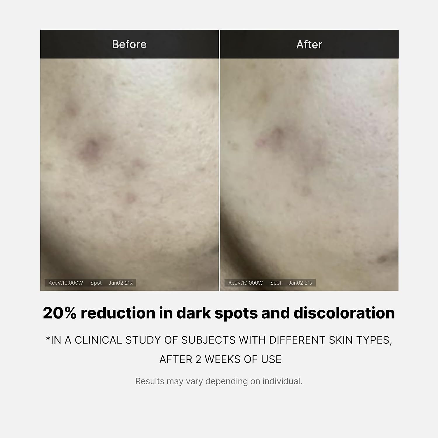 image:imagemedicube Deep Vita C Serum 20 Pure Vitamin C for Radiance amp Glow Helps Improve the Look of Uneven Skin Tone Korean Skincare 10 g x 3 Bottles035 Fl Oz Pack of 3