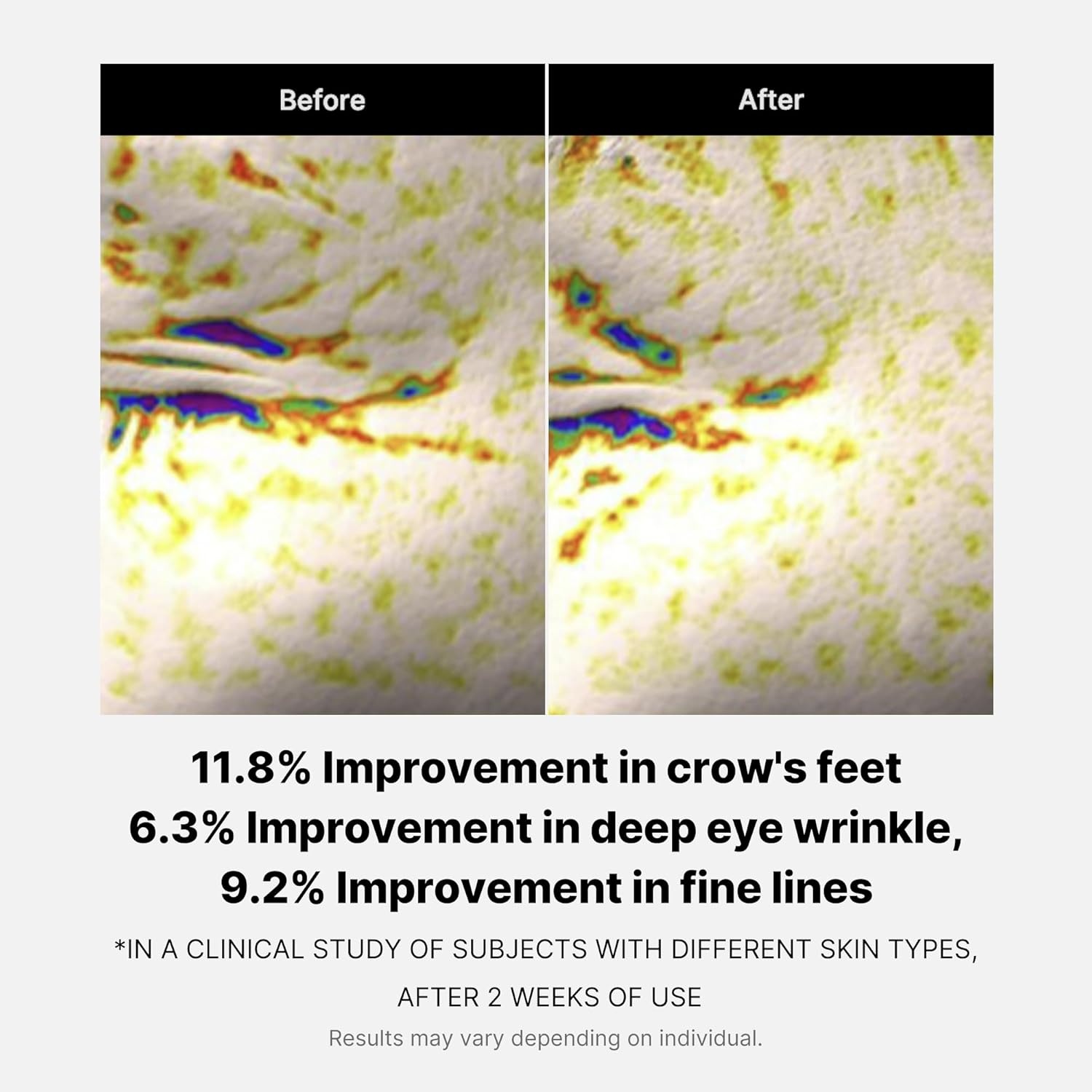 image:imagemedicube Eye Serum Duo for FirmerLooking Skin PDRN Peptide Serum and Deep Reviving Peptide Eye Cream Korean Skincare Gifts for Women Skin Care Set