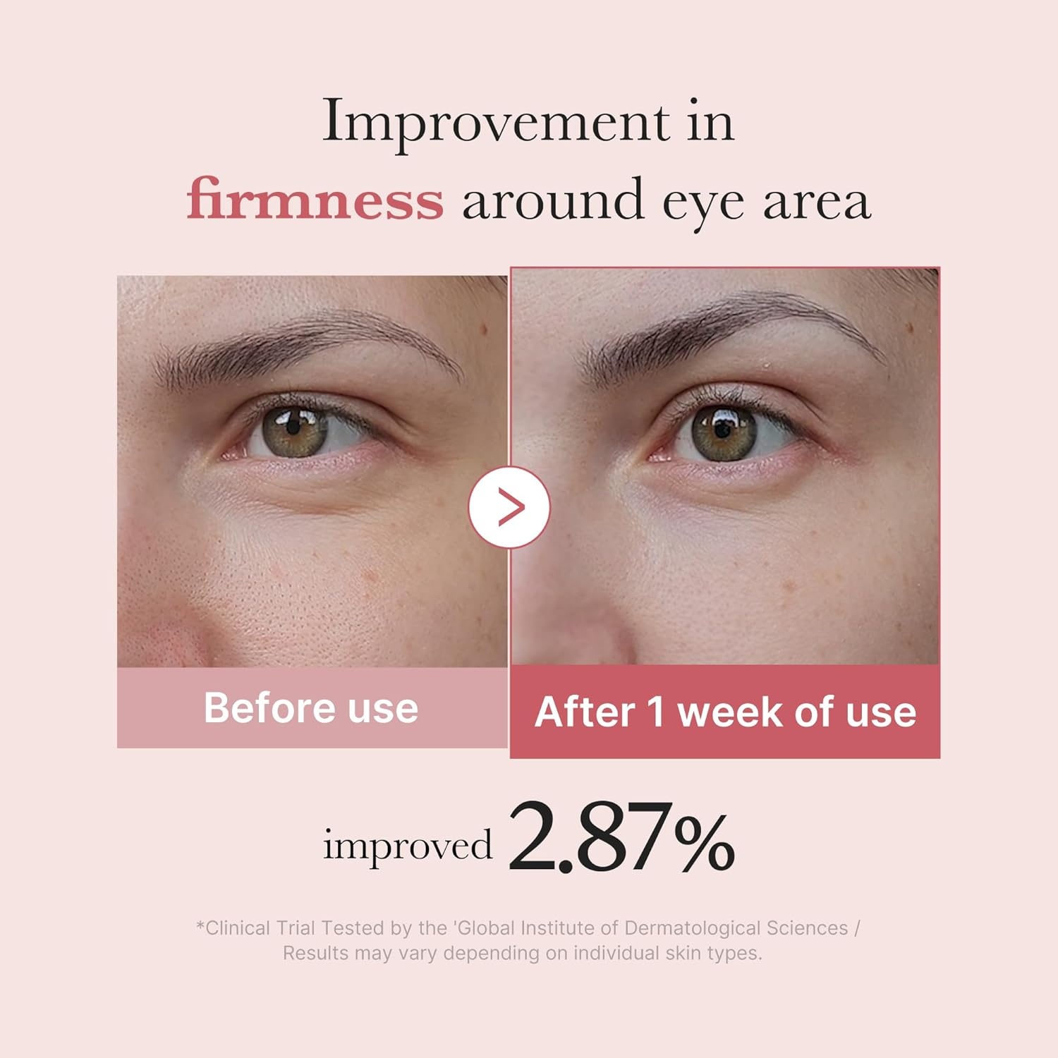 image:imagemedicube Eye Serum with Kojic Acid Turmeric AllDay Brightening Eye Gel Serum Refreshing Eye Care with Vitamin C Retinol amp Caffeine Hydrating amp Cooling Formula Korean Skincare 101 floz101 Fl Oz Pack of 1