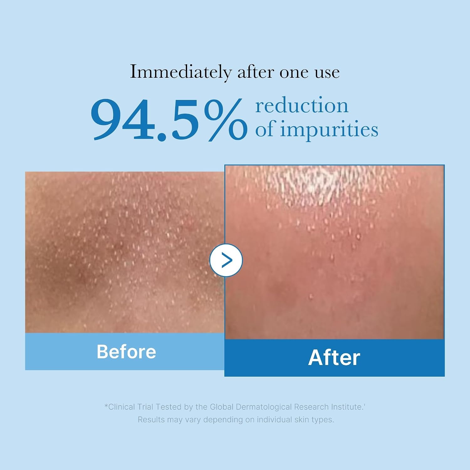 image:imagemedicube Glass Glow Flawless Pore Care Duo Zero Pore Blackhead Cleansing Oil and Zero Pore Toner