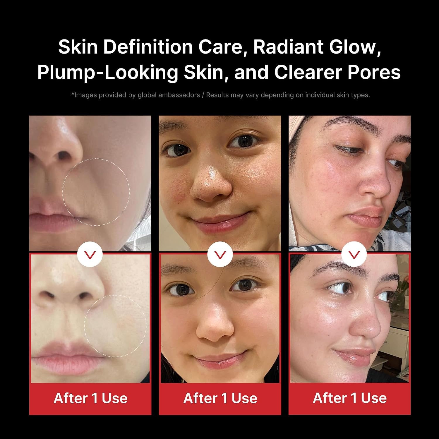image:imagemedicube Hydration Boost Facial Device Set Hyaluronic Acid Moisturizing Jelly Cream and Booster Pro Black For Radiant and FirmerLooking Glow Home Care Korean Skincare