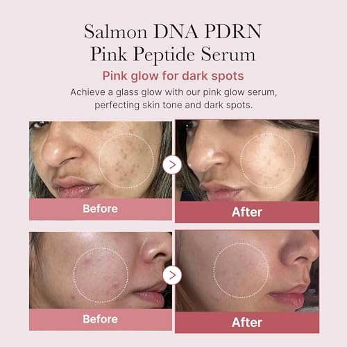 image:imagemedicube Intensive Moisture amp Skin Plumping Set Salmon DNA PDRN Pink Peptide Serum and Salmon DNA PDRN Pink One Day Serum