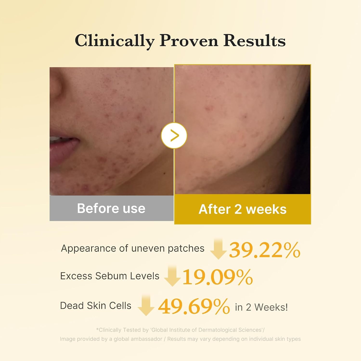 image:imagemedicube Kojic Acid Clarity Duo for Troubled Skin Kojic Acid Turmeric Clarifying Pad and Kojic Acid Turmeric Smoothing Toner for face amp body