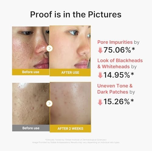 image:imagemedicube Kojic Acid Turmeric Peel amp Tone Facial Duo Turmeric Peel Shot and Kojic Acid Smoothing Toner Gentle Facial Exfoliation amp ToneRefining Care for Uneven Skin Tone amp Texture