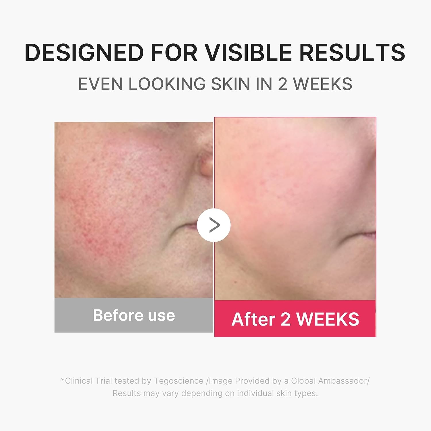 image:imagemedicube Mini Booster Pro Plus Full Facial Device Set 3in1 Korean Facial Device for Makeup Removal amp Pore Cleansing Skin Definition amp Body Care Skincare Boost with 3 Modes PinkPink