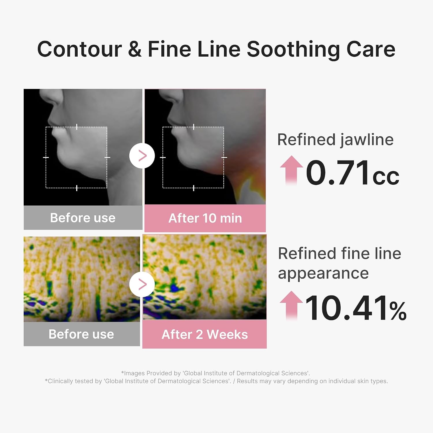 image:imagemedicube PDRN Pink Tension Up Sheet Mask 3Step Contouring Mask FullFace Firming Care with Salmon PDRN NAD amp Caffeine Korean Skincare 34g x 4ea Tightening Band4 Count Pack of 1