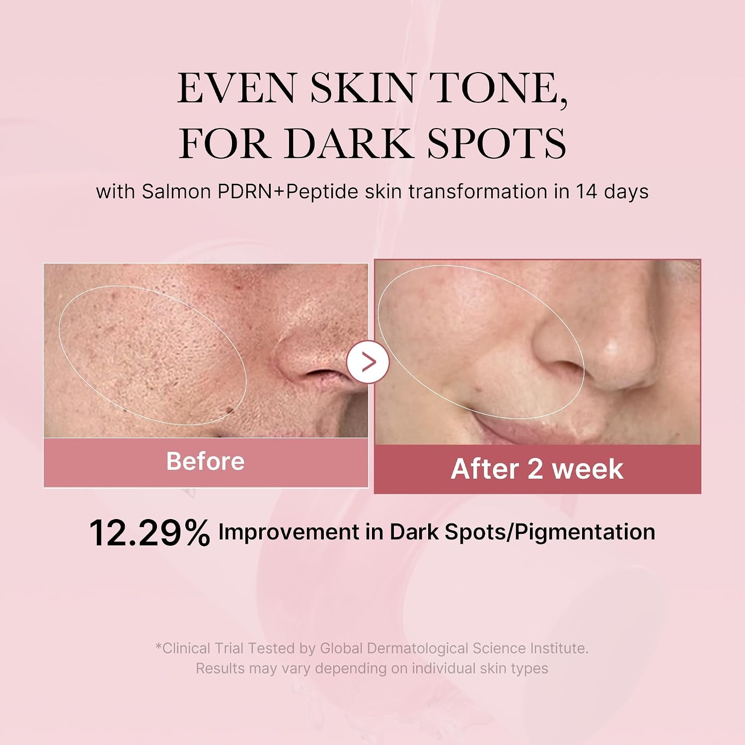 image:imagemedicube PDRN Toner Salmon DNA PDRN CICA Soothing Toner Lightweight Watery Toner with PDRN Niacinamide Peptides For Uneven Skin Tone amp Soothing Korean Skincare 845 fl ozSalmon PDRN Watery