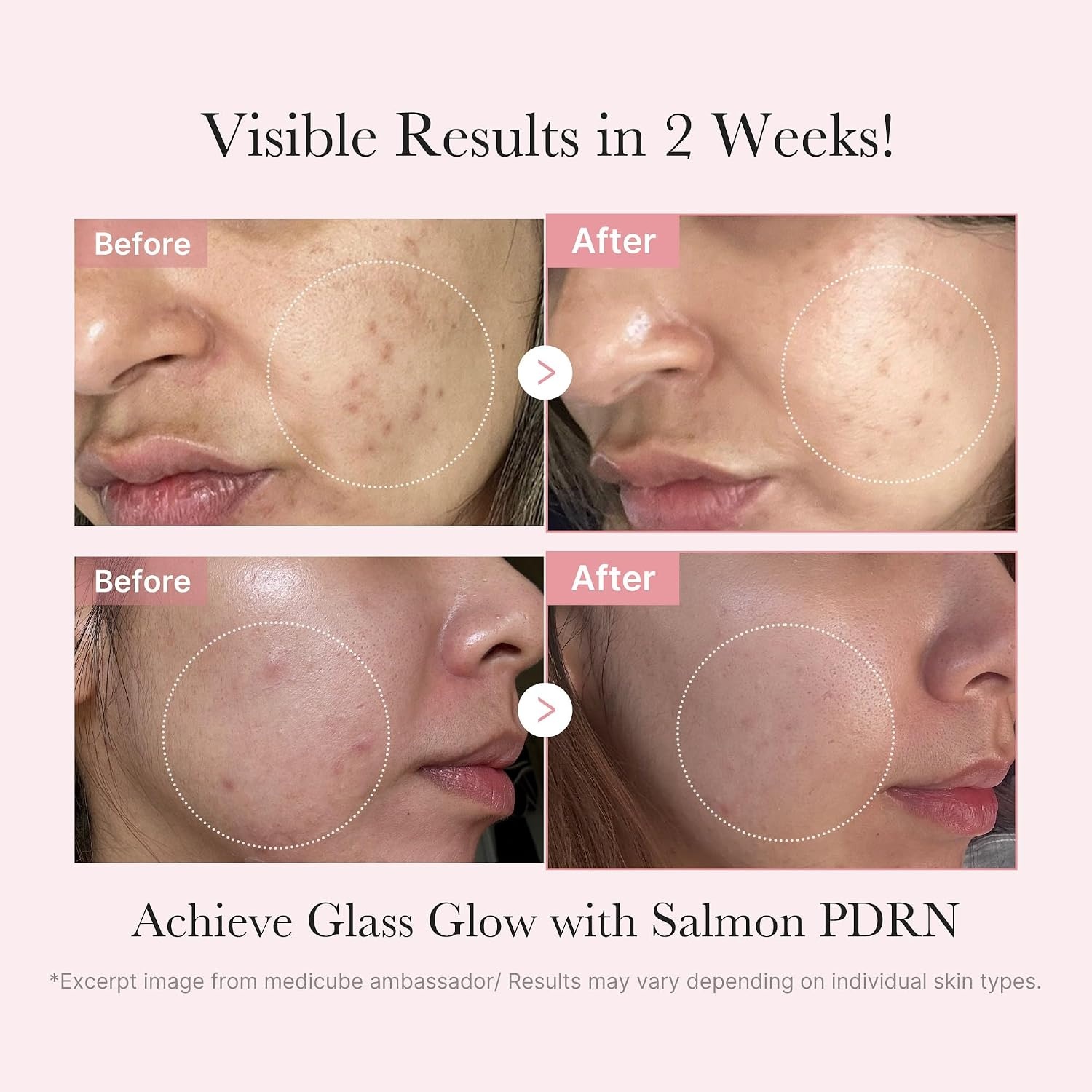image:imagemedicube Pink PDRN Trio Gift Set for Glass Glow Skin