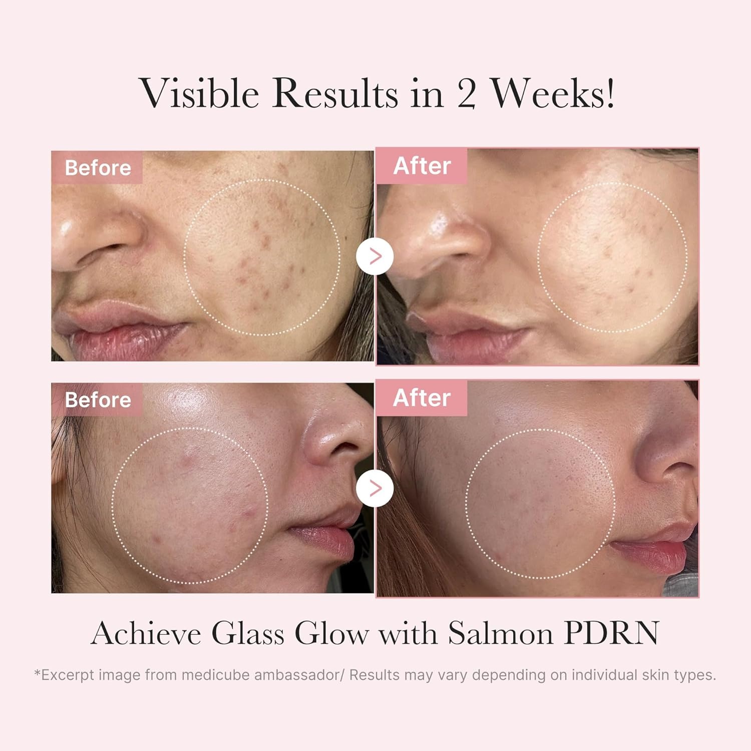image:imagemedicube Salmon DNA PDRN Glow Kit Travel Essential Mini Skincare Set Glass Glow Mini Skincare Set with Toner Serum amp Sheet Mask For Hydrating Firming Moisturizing Korean SkincarePDRN Glow Kit