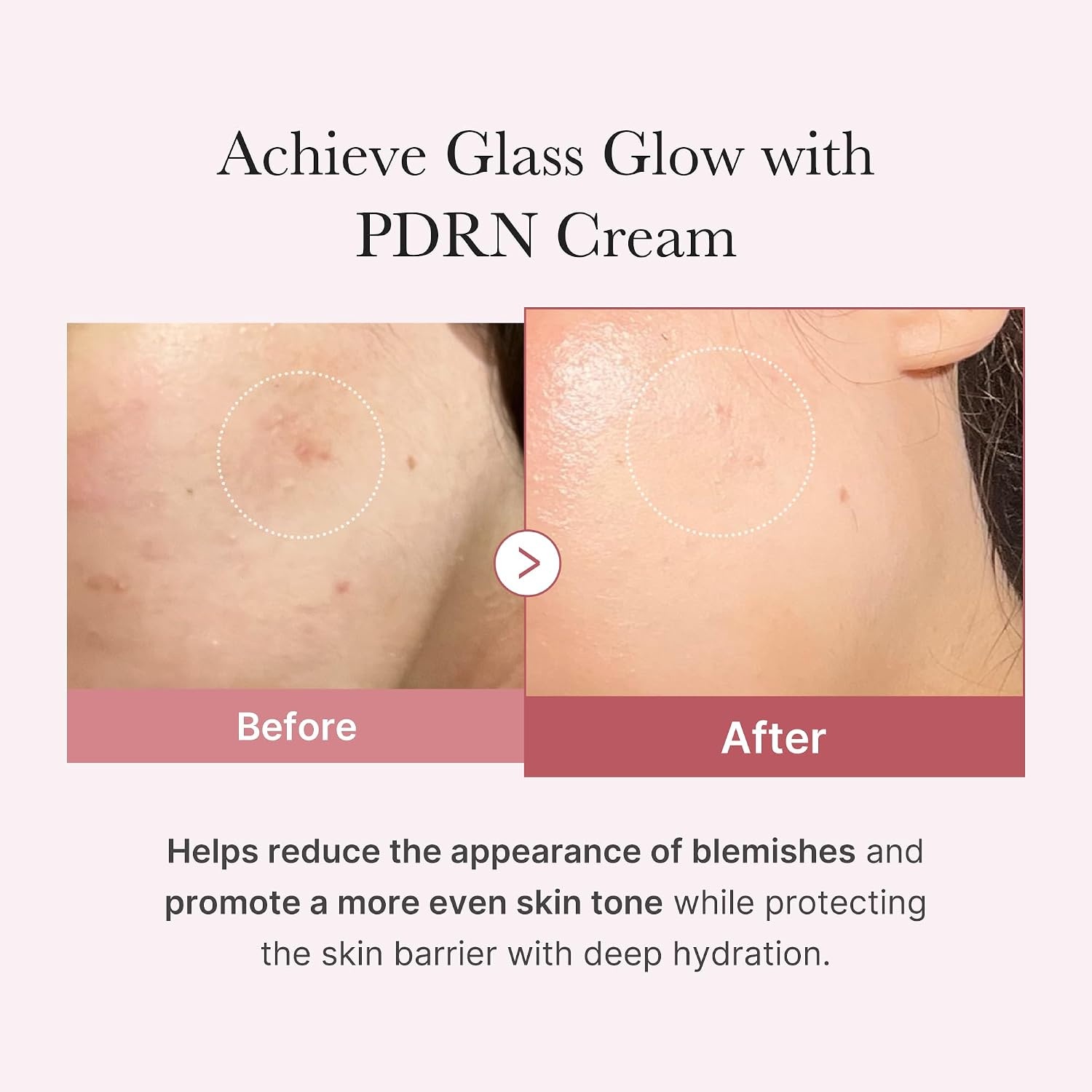 image:imagemedicube Salmon DNA PDRN Pink Hyaluronic Moisturizing Cream Blemish Relief Hydration amp Elasticity Care For the Look of Uneven Skin Tone amp Pores Korean Skincare 169 fl ozSalmon DNA PDRN