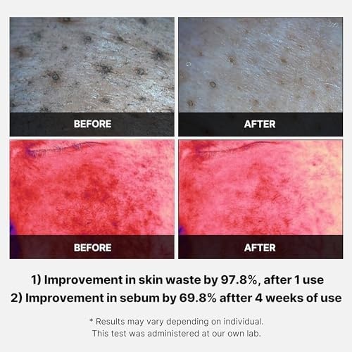 image:imagemedicube Swipe amp Spray Red Duo for Troubled Skin Red Succinic Acid Panthenol Facial Peeling Pads and Power Soothing Spray