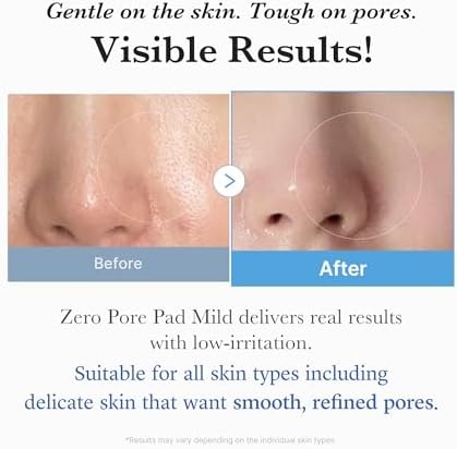 image:imagemedicube Zero Pore Cleanse amp Swipe Duo Zero Pore Pad Mild Zero Capsule Foam Cleanser Exfoliating and Clarifying Pore Care Set for Refined Skin Texture and Excess Sebum Control