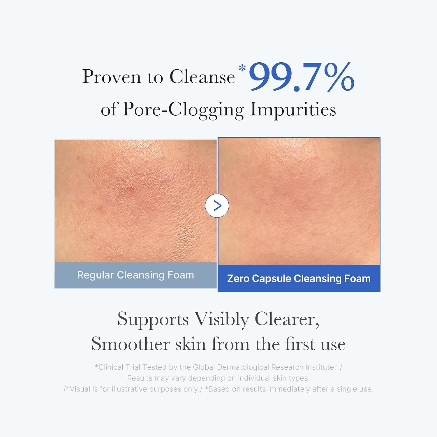 image:imagemedicube Zero Pore Cleanse amp Swipe Duo Zero Pore Pad Mild Zero Capsule Foam Cleanser Exfoliating and Clarifying Pore Care Set for Refined Skin Texture and Excess Sebum Control