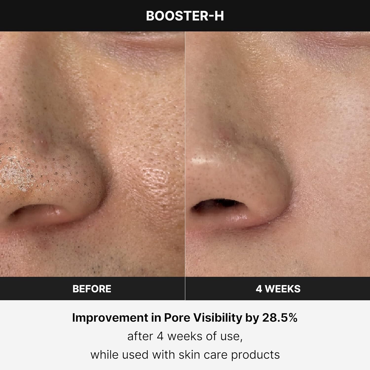 image:imagemedicube Booster H Korean Skincare Tool Facial Glow Booster for Maximizing and Boosting Skin Care Absorption Needle Free