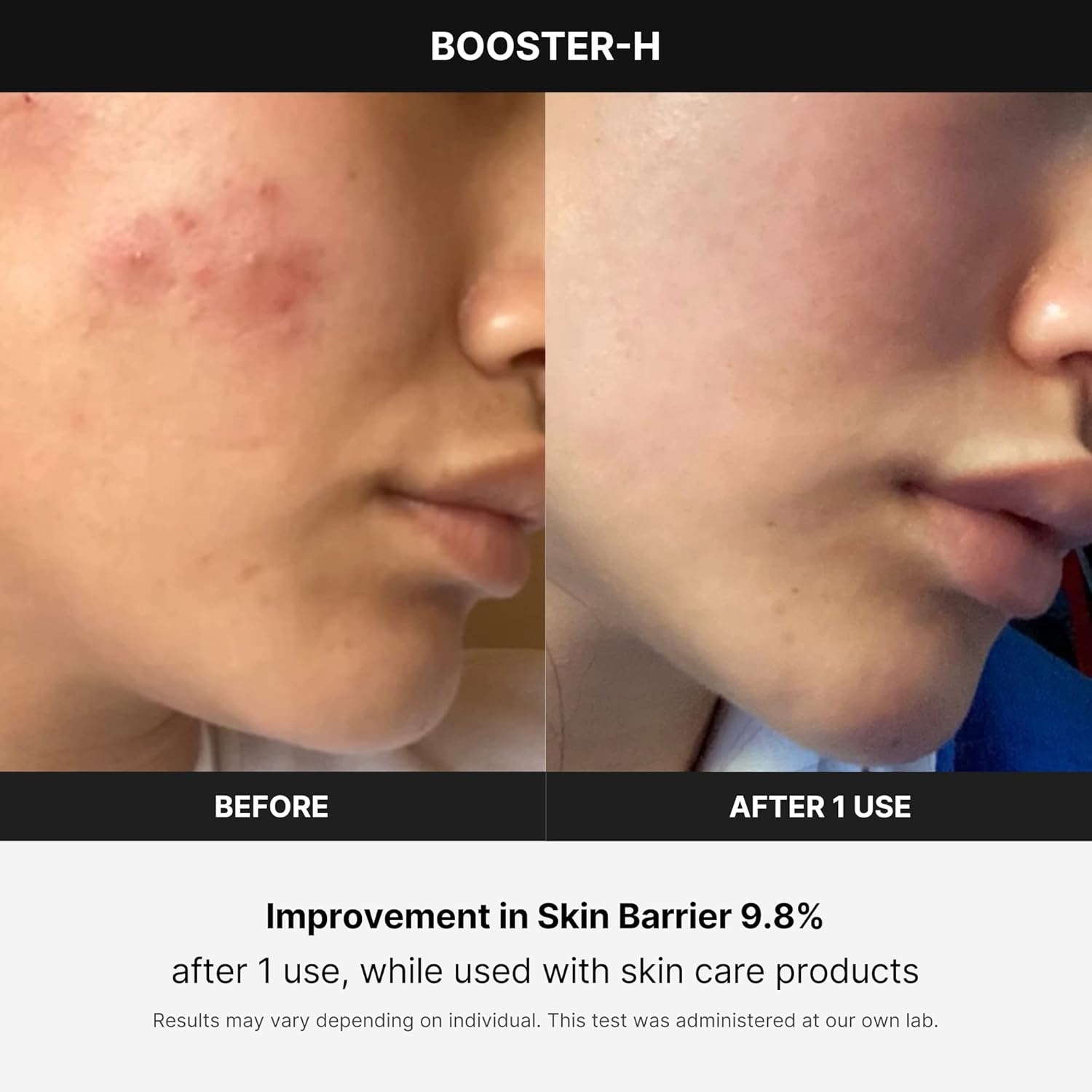 image:imagemedicube Booster H Korean Skincare Tool Facial Glow Booster for Maximizing and Boosting Skin Care Absorption Needle Free