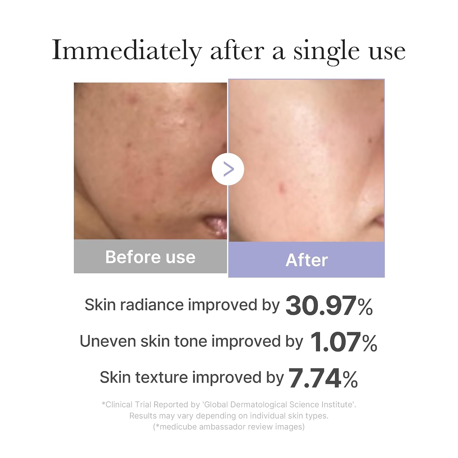 image:imagemedicube Mini Booster Pro Pink Affordable AtHome Facial Device for Beginners Portable Glow Booster for Glass Skin Boosting Skin Care Absorption Skincare for Teens Korean Skin Care