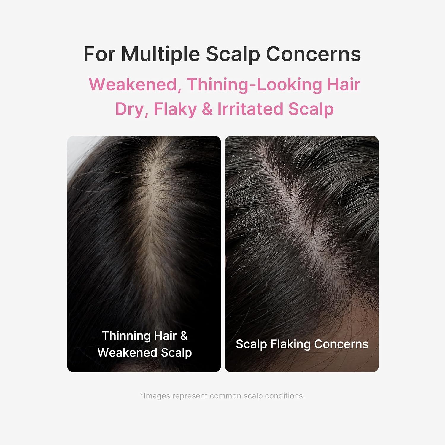 image:imagemedicube Rosemary PDRN Purifying amp Cooling Shampoo and Scalp Serum Duo Purifying Shampoo amp Cooling Scalp Serum SkincareInspired Formula for Fuller StrongerLooking Hair Korean Hair Care